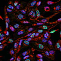 Cancer cell components are shown illuminated in red, blue and green via biophotonics.